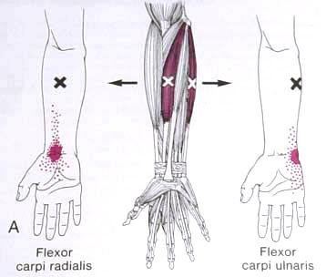 flessore_radiale